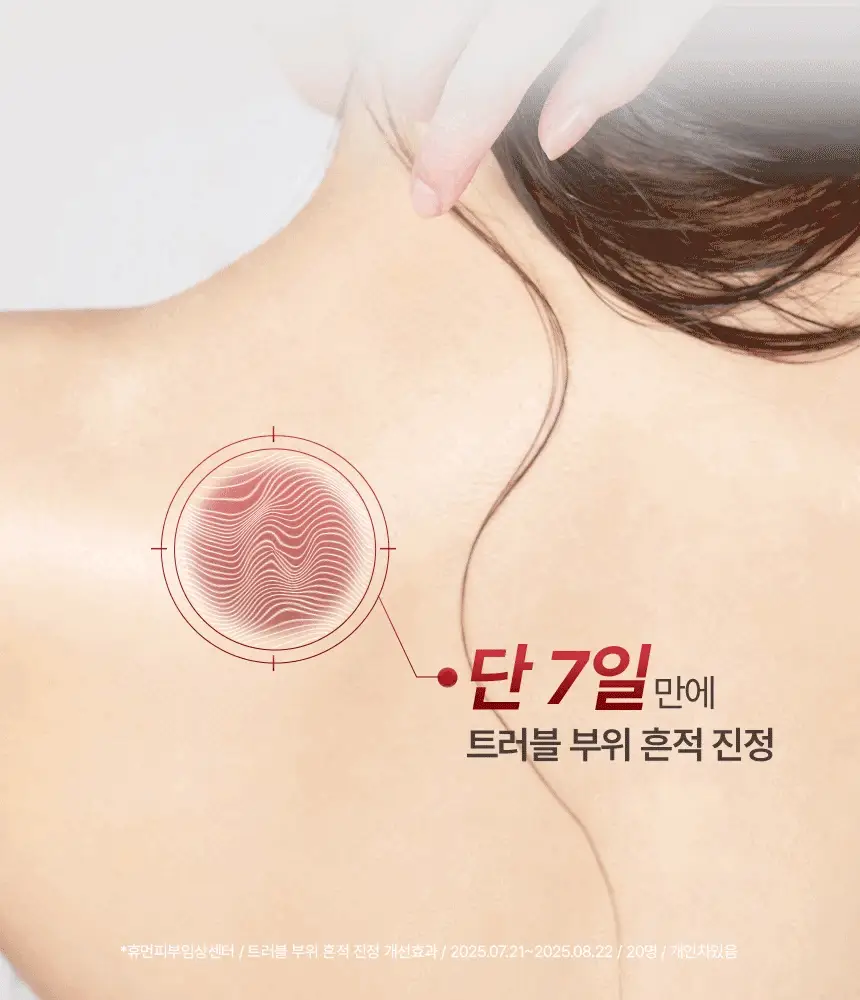 [1위 올인원 바디워시] 노도르 바디워시 460ml 3종 택 1 (올인원 / 아크네 / 모이스춰) 상세페이지 76